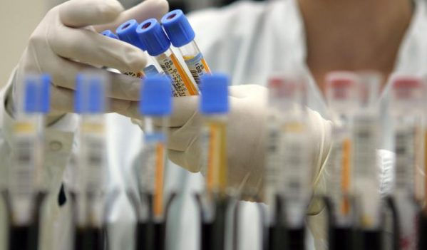 Infectat cu coronavirus desi nu a venit in contact cu o persoana bolnava! Infectat cu coronavirus desi nu a venit in contact cu o persoana bolnava!